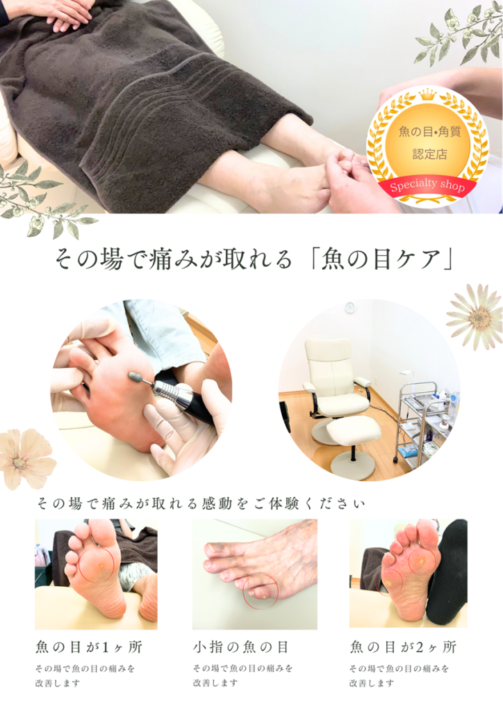 魚の目・角質の専門店/坂井市・福井市・あわら市